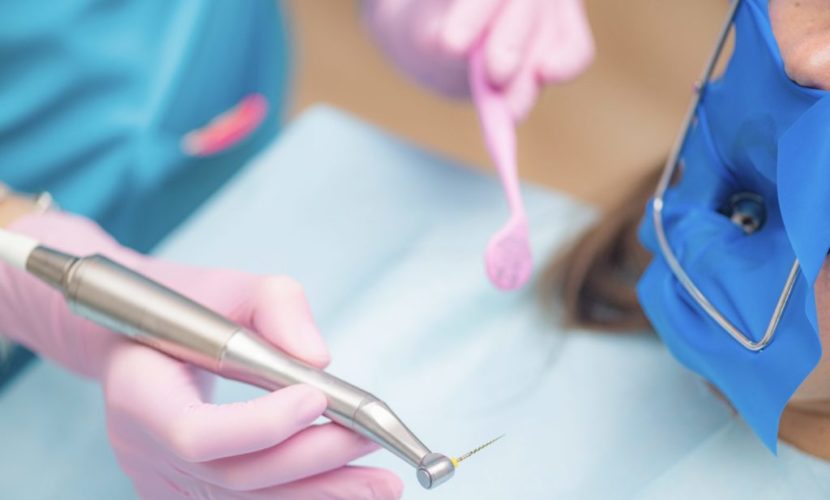 root canal treatment in Spring, Tx